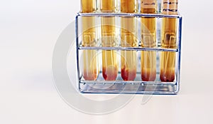 Microbiology analysis E.Coli in food sample use Most Probable number MPN technique for testing Coliform bacteria cultured. photo