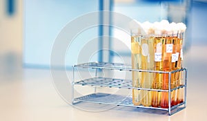 Microbiology analysis E.Coli in food sample use Most Probable number MPN technique for testing Coliform bacteria cultured. photo