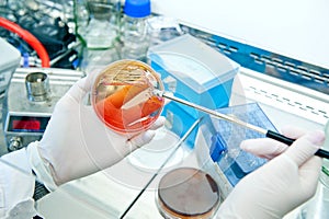 Microbiology - bacteria culture photo