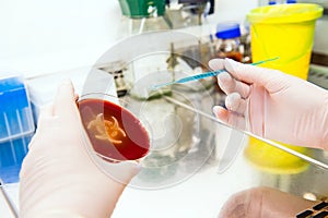 Microbiology biohazard - bacteria culture