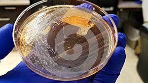 Microbiology culture plate with white Salmonella colonies