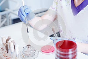 Microbiology hand medical working on agar plate culture bacteria and drug resistance of pathogens in laboratory and