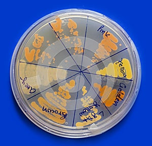Microbiology: Ioslated coloured Baceterial Colonies