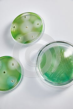 Microbiology Laboratory. Petri Dishes with Various Bacteria Samples