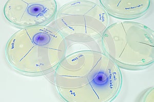 Microbiology laboratory test