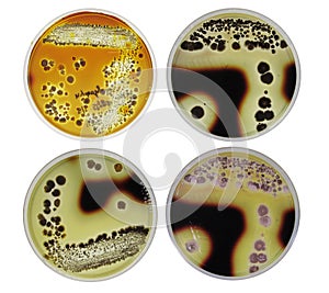 Microbiology strach agar test by bacteria