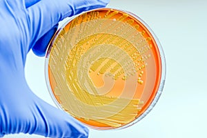 Micrococcus luteus photo