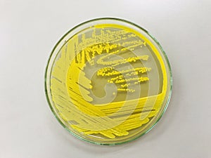 Micrococcus luteus photo