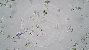 Microcosm of the amoeba moves in water among algae close-up timelapse