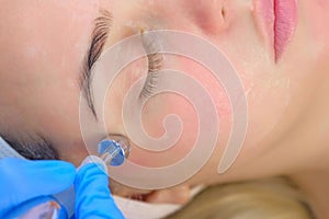 Microcurrent face treatment with hyaluronic acid gel for young woman, closeup.