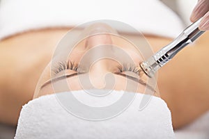 Microdermabrasion cosmetic procedure photo