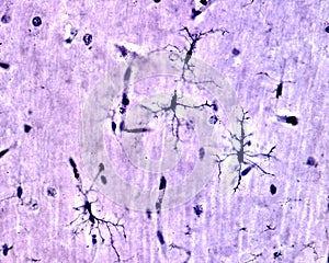 Microglia. Silver carbonate of Rio Hortega photo