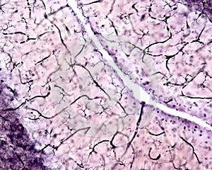 Microglia. Cerebellar cortex