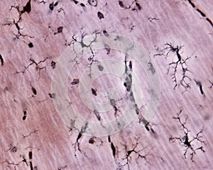 Microglia cell Silver carbonate photo