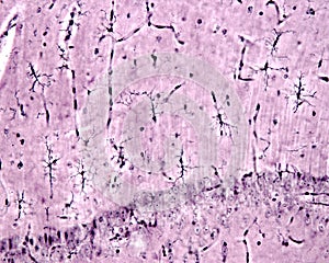 Microglia. Hippocampus photo