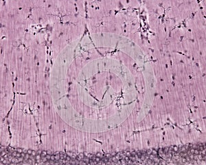 Microglia cells. Hippocampus