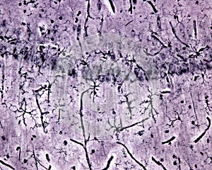 Microglia cells. Silver carbonate
