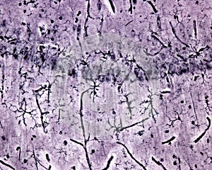 Microglia cells. Silver carbonate photo
