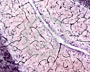 Microglia. Cerebellar cortex photo