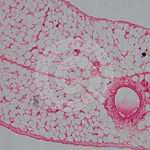 Micrograph of blood vessel, artery