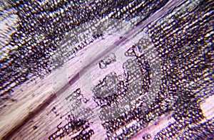 Micrograph Crocus photo