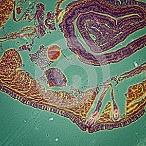 Micrograph earthworm crosscutting