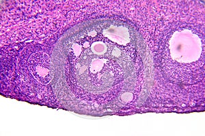 micrograph of ovary showing primordial, primary and secondary follicles isolated on white background.