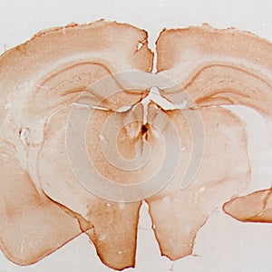 Micrograph of rat brain