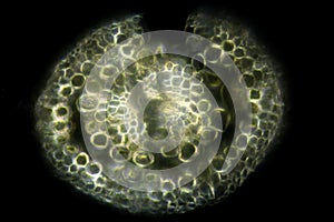 Micrograph of a seta cross section in Polytrichum moss. photo