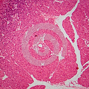 Micrograph of small intestinum