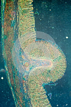 Micrograph of stomach tissue