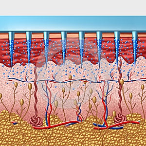 Microneedle Medical device