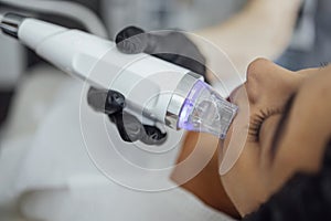 Microneedle RF lifting procedure. Hardware cosmetology photo