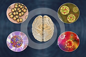 Microorganisms that cause brain infections