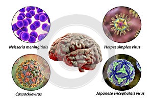 Microorganisms that cause brain infections