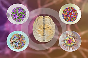 Microorganisms that cause brain infections