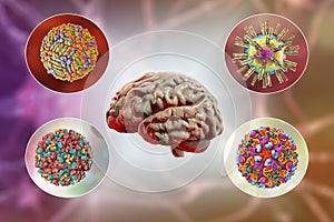 Microorganisms that cause brain infections