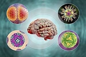 Microorganisms that cause brain infections