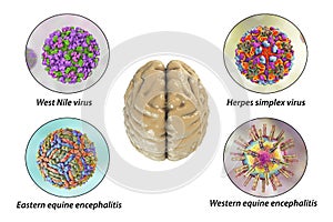 Microorganisms that cause brain infections