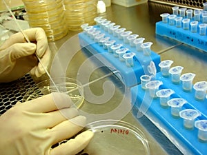 Microorganisms selection