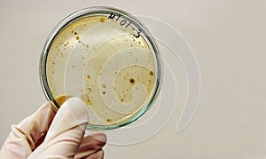 Microorganisms selection