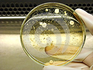 Microorganisms selection