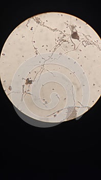 microorganisms in urine