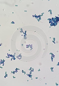 Microphotography of Inmunology test, 400x magnification of marscreen or mar test