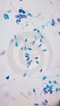 microphotography show test acrosomal integrity in human semen