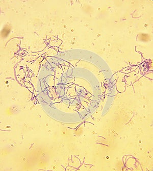 Microscope-Anthrax-Bacillus anthracis photo