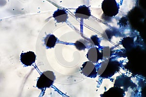 Microscope of black fungus spore strain with Lactophenol cotton blue.