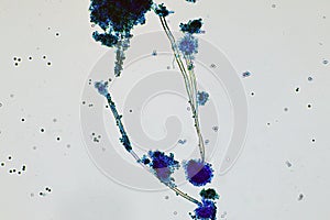 Microscope of black fungus spore strain with Lactophenol cotton blue