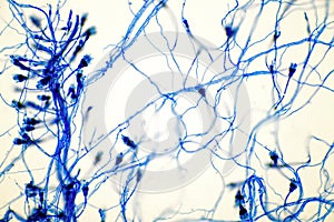 Microscope of black fungus spore strain with Lactophenol cotton blue, molds or yeasts with macro 40x lens, contamination in air