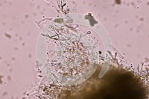 Microscope of black fungus spore strain with Lactophenol cotton red.